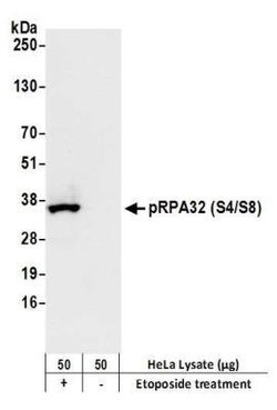 RPA2, p Ser8, p Ser4 Antibody (BL-165-5F1), Novus Biologicals 100 &mu;L | Buy Online | Novus Biologicals | Fisher Scientific