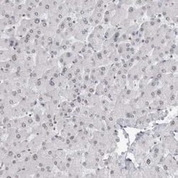 RPA2 Antibody, Novus Biologicals 25 &mu;L; Unconjugated:Antibodies, Polyclonal