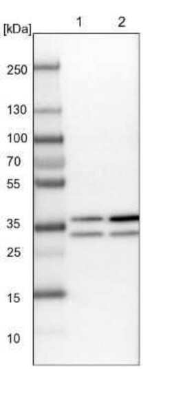 RPA2 Antibody, Novus Biologicals 25 &mu;L; Unconjugated:Antibodies, Polyclonal