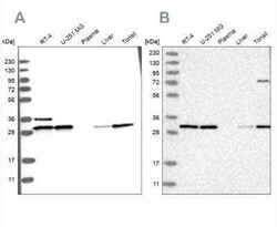 RPA2 Antibody, Novus Biologicals 25 &mu;L; Unconjugated:Antibodies, Polyclonal