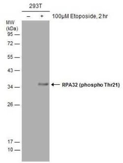 RPA2, p Thr21 Antibody, Novus Biologicals 100 &mu;g; Unconjugated:Antibodies,