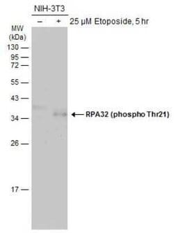 RPA2, p Thr21 Antibody, Novus Biologicals 100 &mu;g; Unconjugated:Antibodies,