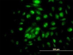 RPA4 Antibody, Novus Biologicals 0.05 mg | Buy Online | Novus Biologicals | Fisher Scientific