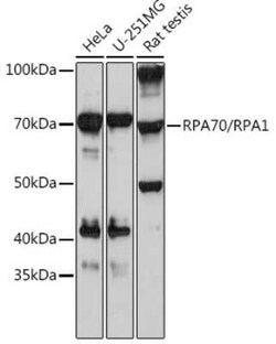 RPA70 Rabbit anti-Human, Rat, Clone: 5R7S3, Novus Biologicals 100 &mu;g;