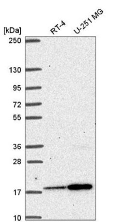 RPB8 Antibody, Novus Biologicals RPB8 Antibody; Unconjugated; 100 &mu;L:Antibodies,