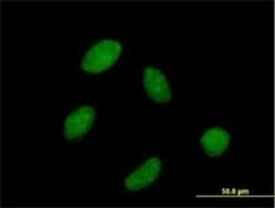 RPC62 Antibody, Novus Biologicals 0.05 mg | Buy Online | Novus Biologicals | Fisher Scientific