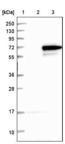 RPC62 Antibody, Novus Biologicals 25 &mu;L; Unconjugated:Antibodies, Polyclonal