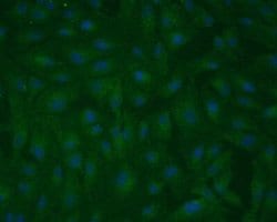 RPE65 Antibody (401.8B11.3D9) - Azide and BSA Free, Novus Biologicals 0.2