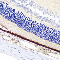 RPE65 Rabbit anti-Mouse, Rat, Clone: 5X1F6, Novus Biologicals 100 &mu;g;