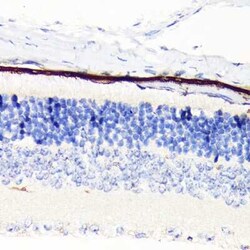 RPE65 Rabbit anti-Mouse, Rat, Clone: 5X1F6, Novus Biologicals 100 &mu;g;