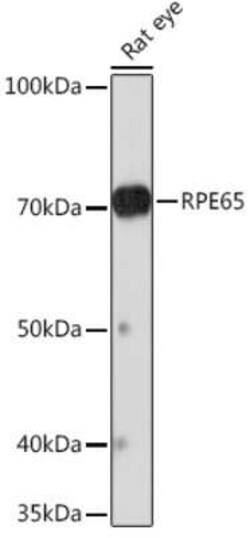 RPE65 Rabbit anti-Mouse, Rat, Clone: 5X1F6, Novus Biologicals 100 &mu;g;