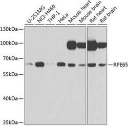 RPE65 Antibody - BSA Free, Novus Biologicals:Antibodies:Primary Antibodies