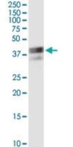 RPIP8 Antibody (1A8), Novus Biologicals 0.1 mg | Buy Online | Novus Biologicals | Fisher Scientific