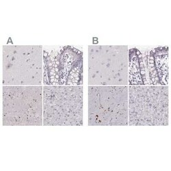 RPIP8 Antibody, Novus Biologicals:Antibodies:Primary Antibodies