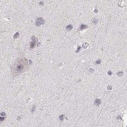RPIP8 Antibody, Novus Biologicals:Antibodies:Primary Antibodies