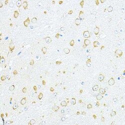 RPL10A Antibody - BSA Free, Novus Biologicals 0.02 mL; Unconjugated:Antibodies,