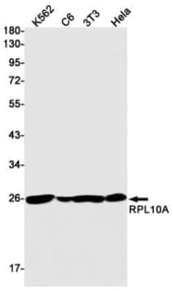 RPL10A Antibody (S08-9H8), Novus Biologicals 100 &mu;g | Buy Online | Novus Biologicals | Fisher Scientific