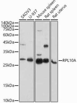RPL10A Antibody - BSA Free, Novus Biologicals 0.02 mL; Unconjugated:Antibodies,