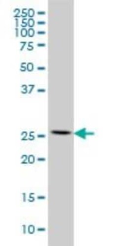RPL13 Antibody (3F6), Novus Biologicals 0.1 mg | Buy Online | Novus Biologicals | Fisher Scientific