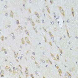 RPL13 Antibody - BSA Free, Novus Biologicals 0.02 mL | Buy Online | Novus Biologicals | Fisher Scientific
