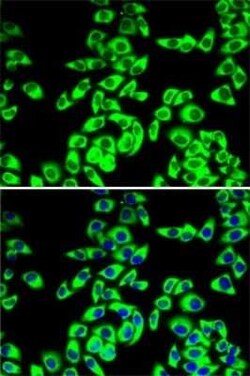 RPL14 Antibody - BSA Free, Novus Biologicals 0.1 mL | Buy Online | Novus Biologicals | Fisher Scientific