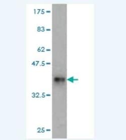 RPL18 Antibody (3D5), Novus Biologicals 0.1 mg | Buy Online | Novus Biologicals | Fisher Scientific