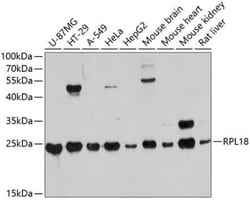 RPL18 Antibody - Azide and BSA Free, Novus Biologicals 0.1 mL | Buy Online | Novus Biologicals | Fisher Scientific