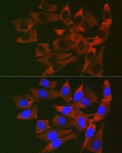 RPL19 Rabbit anti-Human, Mouse, Rat, Polyclonal, Novus Biologicals 100