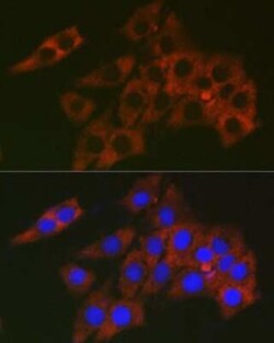 RPL19 Rabbit anti-Human, Mouse, Rat, Polyclonal, Novus Biologicals 100