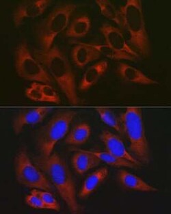 RPL19 Rabbit anti-Human, Mouse, Rat, Polyclonal, Novus Biologicals 100