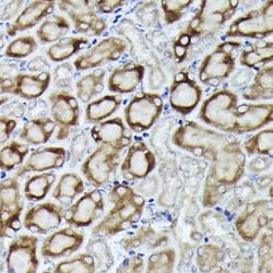 RPL19 Rabbit anti-Human, Mouse, Rat, Polyclonal, Novus Biologicals 100