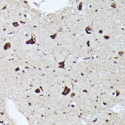 RPL19 Rabbit anti-Human, Mouse, Rat, Polyclonal, Novus Biologicals 100