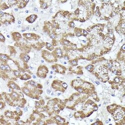 RPL19 Rabbit anti-Human, Mouse, Rat, Polyclonal, Novus Biologicals 100