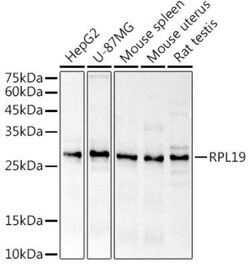 RPL19 Rabbit anti-Human, Mouse, Rat, Polyclonal, Novus Biologicals 100