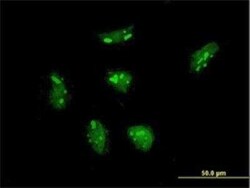 RPL21 Antibody (2D8), Novus Biologicals 0.1 mg | Buy Online | Novus Biologicals | Fisher Scientific