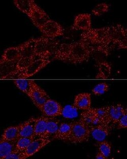 RPL21 Antibody - Azide and BSA Free, Novus Biologicals:Antibodies:Primary