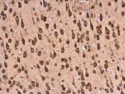 RPL22 Antibody, Novus Biologicals 100 &mu;g; Unconjugated:Antibodies, Polyclonal