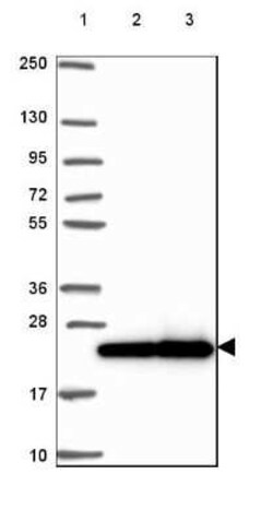 RPL29 Antibody, Novus Biologicals 25 &mu;L, Unconjugated:Antibodies, Polyclonal