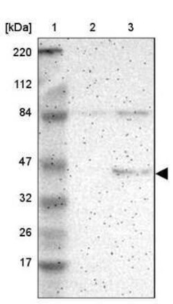 RPL3 Antibody, Novus Biologicals 0.1 mL | Buy Online | Novus Biologicals | Fisher Scientific
