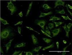 RPL36A Antibody (5F8), Novus Biologicals 0.1 mg | Buy Online | Novus Biologicals | Fisher Scientific