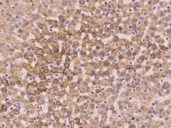 RPL37A Antibody, Novus Biologicals 100 &mu;g | Buy Online | Novus Biologicals | Fisher Scientific