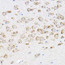RPL4 Antibody - BSA Free, Novus Biologicals:Antibodies:Primary Antibodies