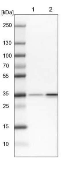 RPL5 Antibody, Novus Biologicals 25ul; Unconjugated:Antibodies, Polyclonal