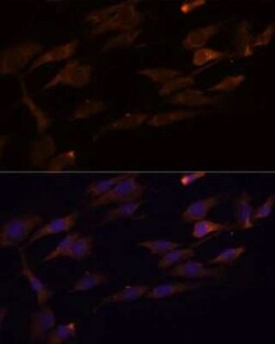 RPL7A Antibody - Azide and BSA Free, Novus Biologicals 0.1 mL; Unconjugated:Antibodies,