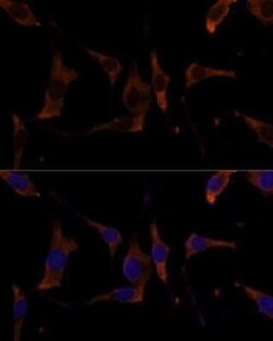 RPL7A Antibody - Azide and BSA Free, Novus Biologicals:Antibodies:Primary