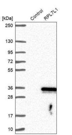 RPL7L1 Antibody, Novus Biologicals 25 &mu;L | Buy Online | Novus Biologicals | Fisher Scientific