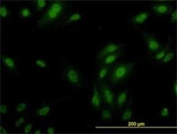 Novus Biologicals RPL9 Antibody (2F11), Novus Biologicals 0.1 mg | Buy Online | Novus Biologicals&trade; | Fisher Scientific
