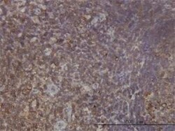 Novus Biologicals RPL9 Antibody (2F11), Novus Biologicals 0.1 mg | Buy Online | Novus Biologicals&trade; | Fisher Scientific