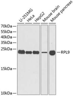 RPL9 Antibody - BSA Free, Novus Biologicals 0.1 mL; Unconjugated:Antibodies,