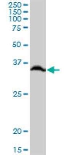 RPLP0 Antibody, Novus Biologicals 0.05 mg, Unconjugated:Antibodies, Polyclonal